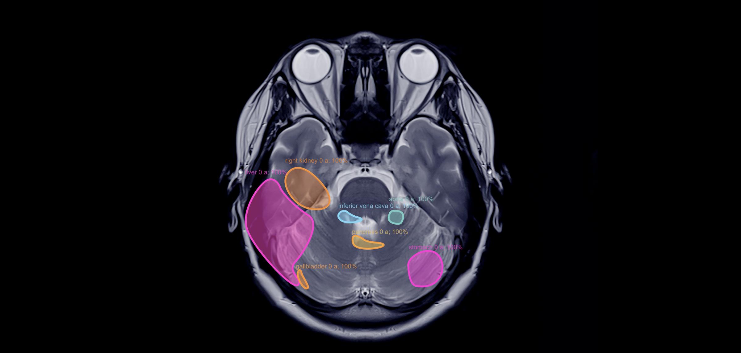 AI in medical imaging