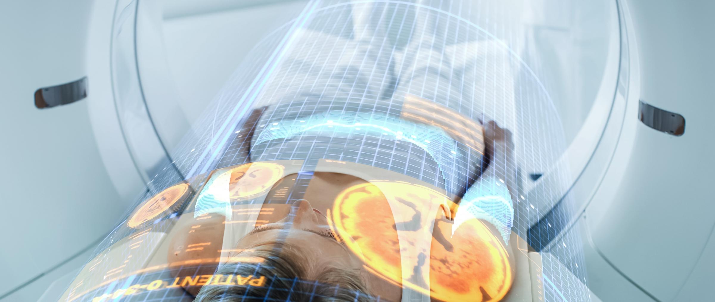 AI in medical imaging