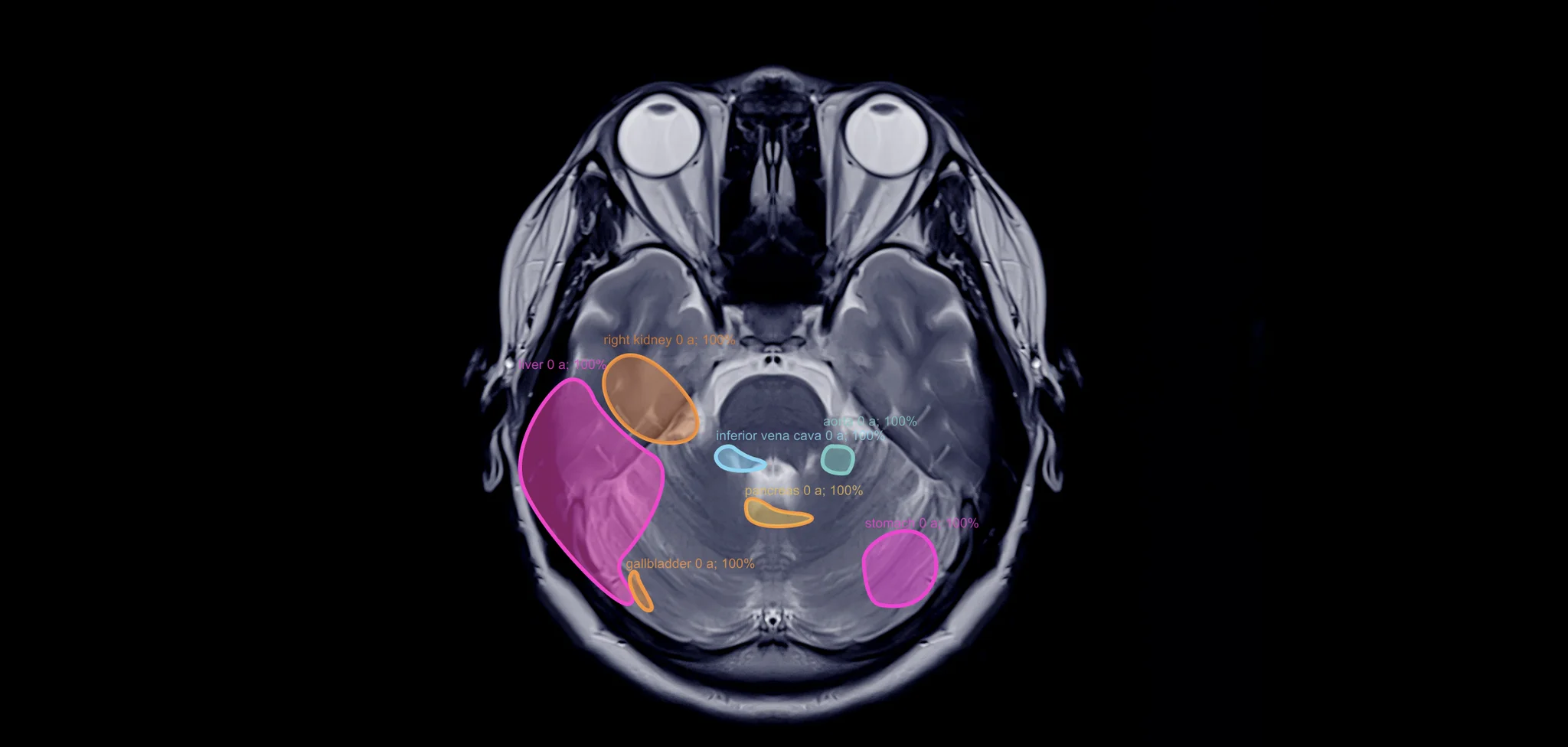 AI in medical imaging
